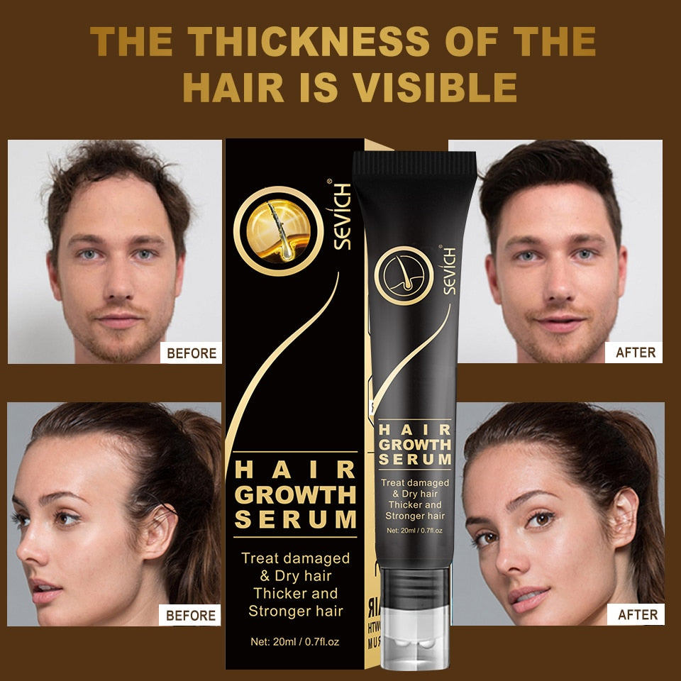 Hair Growth Serum