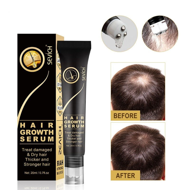 Hair Growth Serum